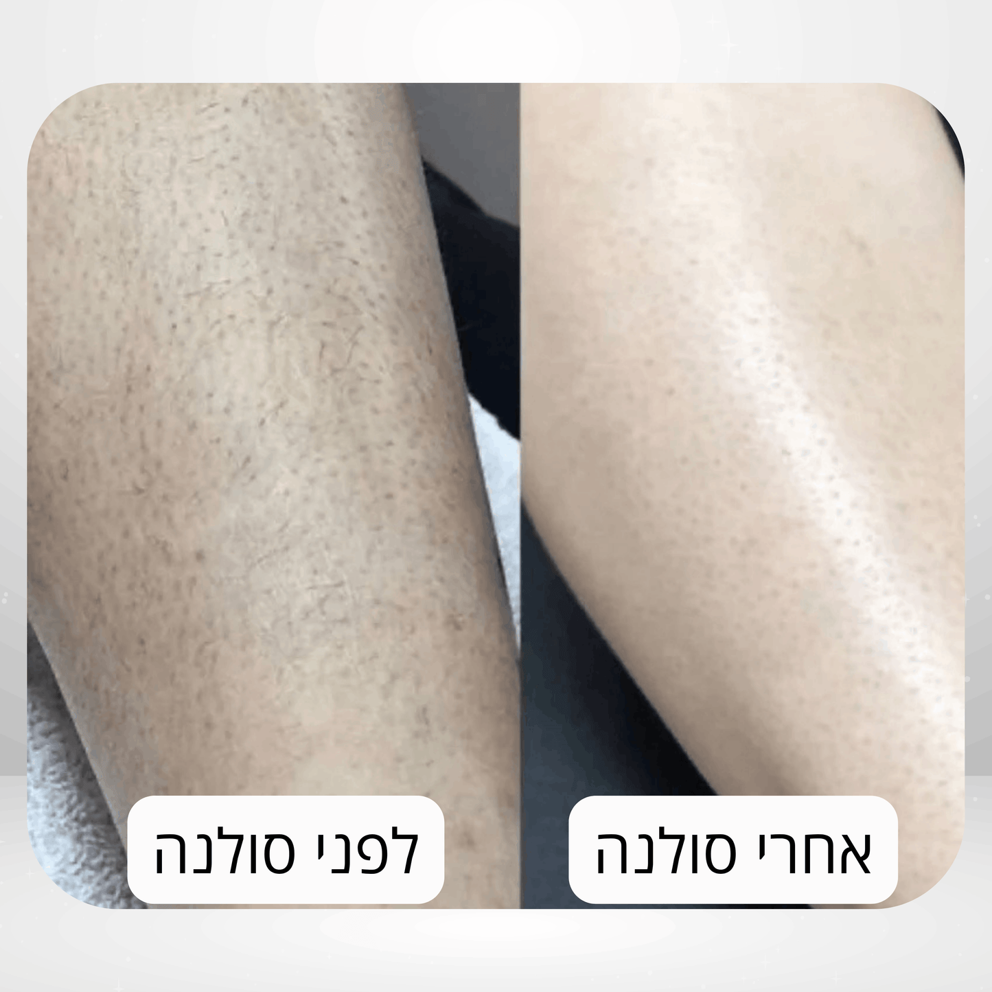 מוחק השיער של - ™Solana