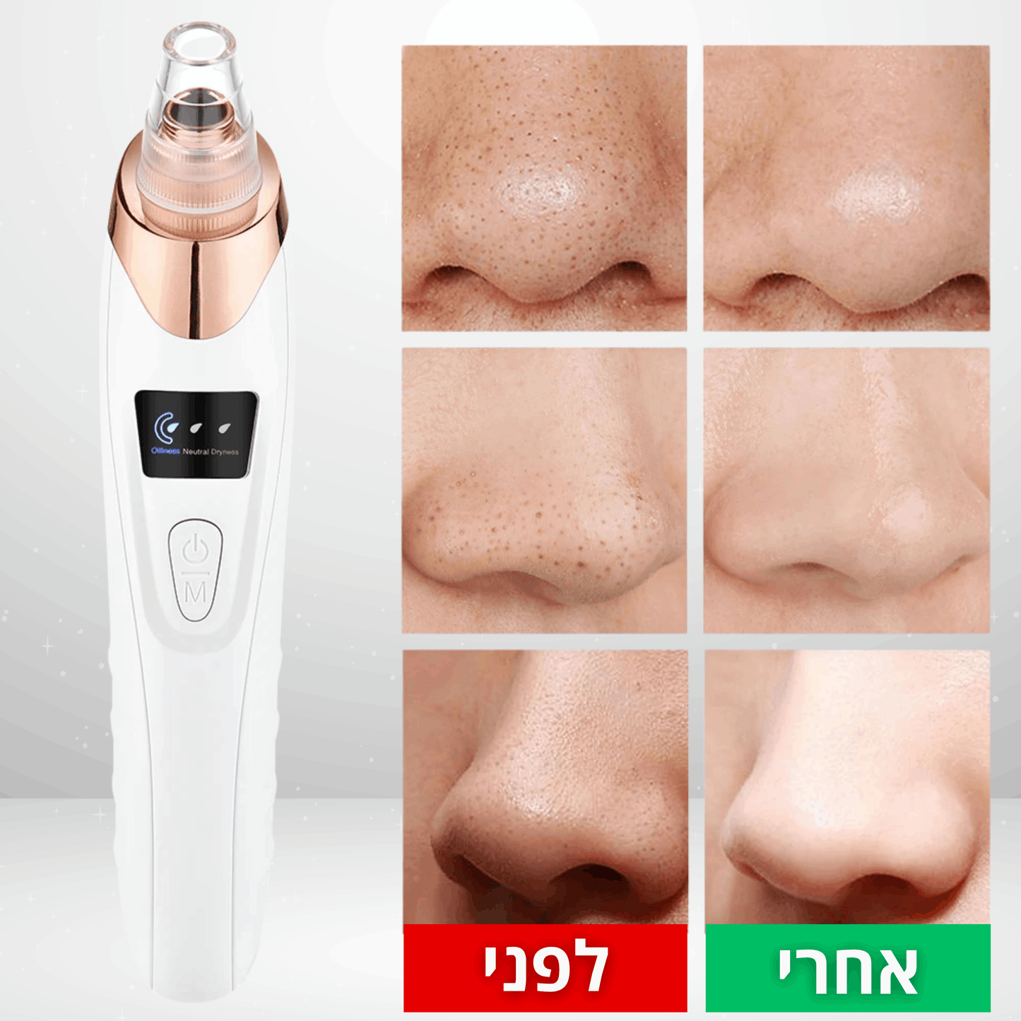 Solana™ – מכשיר ביתי להסרת שחורים