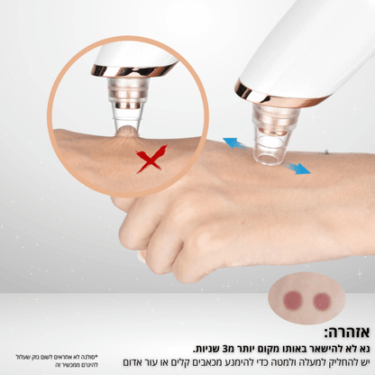 Solana™ – מכשיר ביתי להסרת שחורים