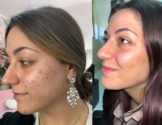 וידאו נטען: סרטון הדרכה מלא למכשיר של סולנה